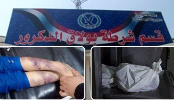 تفاصيل مقتل "علا" طفلة الحضانة على يد والدها ببولاق الدكرور.. المتهم سدد لها عدة ضربات بماسورة بسبب "الواجب".. ويعترف: حاولت أذاكر لها لكن مبتفهمش.. كان قصدى أضربها علقة مش أقتلها.. والنيابة تأمر بحبسه 4 أيام - اليوم السابع