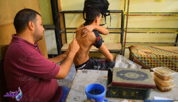 شاهد.. «لدغ النحل» أحدث طرق علاج الأمراض (فيتشر)