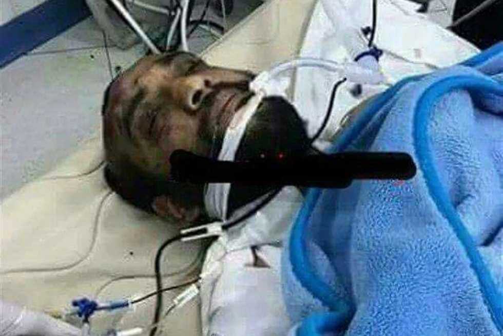 مصادر بـ«الداخلية» تعلن آخر تطورات الحالة الصحية لـ«إرهابي حلوان»  (خبر)