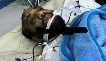 مصادر بـ«الداخلية» تعلن آخر تطورات الحالة الصحية لـ«إرهابي حلوان»  (خبر)