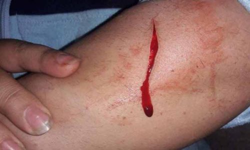 علقة ساخنة لربة منزل طالبت بحضانة أطفالها (خبر)