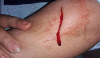 علقة ساخنة لربة منزل طالبت بحضانة أطفالها (خبر)