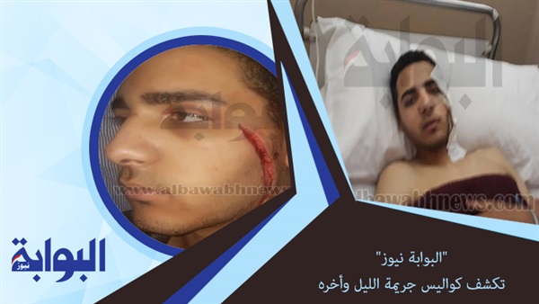 بالصور.. "البوابة نيوز" تكشف كواليس جريمة الليل وأخره.. نجل مستشار سابق يعتدي على شاب ويصيبه بطعنات في مصر الجديدة.. والمجني عليه: "قال لي يابن البواب" (ريبورتاج)