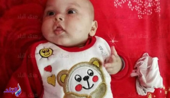 والد طفل مصاب بمرض وراثي يحتاج إلى علاج بـ15 ألف جنيه شهريا: خسرت اثنين من أبنائي بنفس المرض..والتأمين الصحي يرفض علاجه.. وأستغيث بالرئيس لإنقاذ حياته..صور (ريبورتاج)