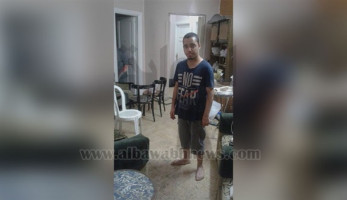 ننشر صورة الشاب المصاب بحشرة خطرة في المعادي (خبر)