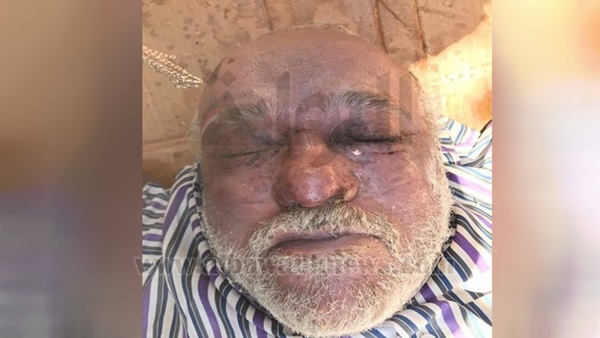 الصورة الأولى لجثة "طبيب مقابر حلوان" (خبر)