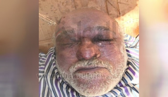 الصورة الأولى لجثة "طبيب مقابر حلوان" (خبر)
