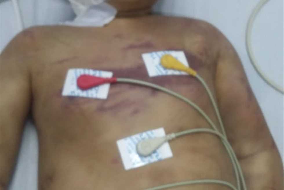 تعذيب طفل بوحشية بالدقهلية: شاهد أمه في وضع مخل مع خطيب شقيقته (التفاصيل)