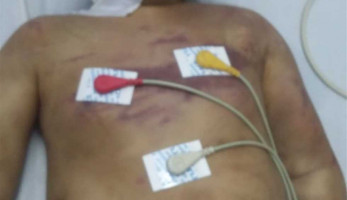 تعذيب طفل بوحشية بالدقهلية: شاهد أمه في وضع مخل مع خطيب شقيقته (التفاصيل)