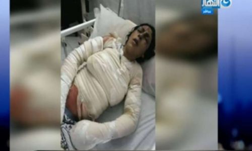 شاهد.. التفاصيل الكاملة لوفاة سيدة وجنينها بسبب حريق داخل مستشفي كفر الشيخ