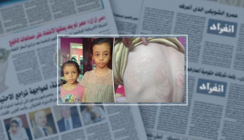صور.. "أباء لا يعرفون الرحمة" سلخانة تعذيب لطفلتين فى المرج على يد زوجة الأب.. سكين ساخن ومياه باردة فى الشتاء وسلك كهرباء أدوات التعذيب.. والطفلتين يصرخان: تمنينا الموت وهربنا كليو مترات على الأقدام