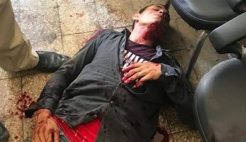 أب يطعن شابا متهما باغتصاب ابنته أثناء عرضه على نيابة كفر الدوار
