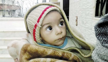 «التقزّم»..  «حكاية فقر وإهمال تشوّه الحياة»