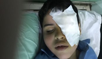 تلميذ بالصف الثانى الابتدائى يفقأ عين زميله بمدرسة فى العاشر من رمضان