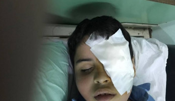 النيابة تُقرر صرف تلميذ فقا عين زميله بالعاشر من رمضان (صور)