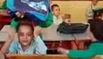 عم "التلميذ الباكي" لـ"الوطن": "ذكي جدا وقدمه المكسورة سبب طلبه النوم"