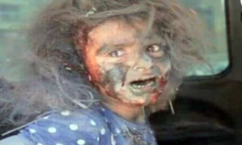 "فيديو.. حقيقة تداول صورة طفلة على أنها من مصابين " أحداث المنيا