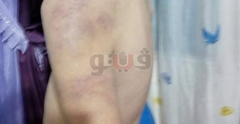 مأساة الطفل إياد ضحية تعذيب زوجة الأب بالإسماعيلية (صور)