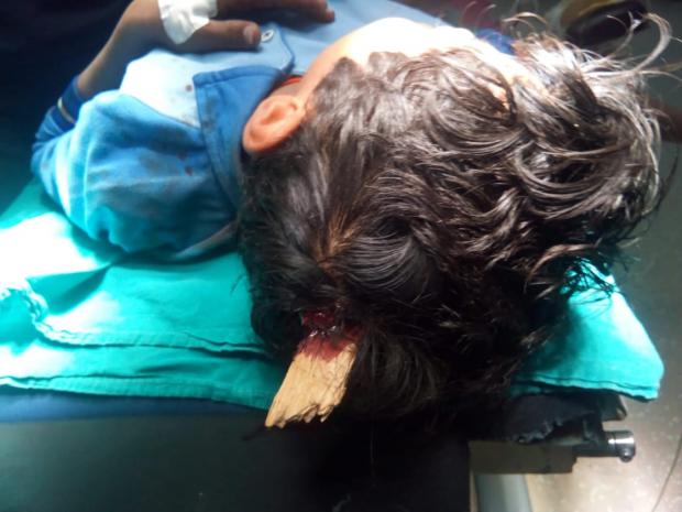 «الأقصر الدولي» ينقذ طفلًا من الموت في جراحة خطيرة