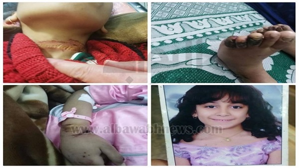 الأب الشيطان.. يعذب ابنته بمعاونة زوجته لمدة 20 يوما