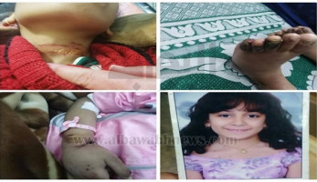 الأب الشيطان.. يعذب ابنته بمعاونة زوجته لمدة 20 يوما