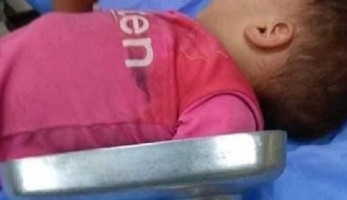 والدة الطفل ضحية "مفرمة اللحمة": "ابني كان بيلعب.. حركته كتيرة"