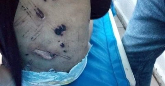 الطفولة والأمومة ينعي جنة.. ويكشف إجراءاته لحماية شقيقتها