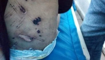 الطفولة والأمومة ينعي جنة.. ويكشف إجراءاته لحماية شقيقتها