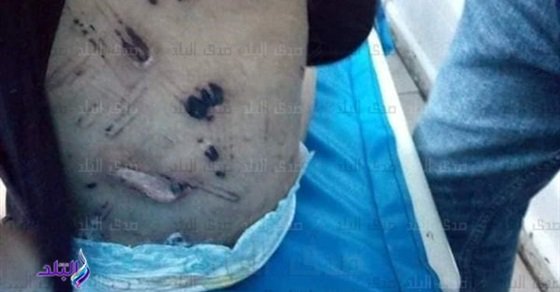 بعد إنكار تعذيبها واغتصابها.. إخلاء سبيل أشقاء والدة الطفلة جنة ضحية التعذيب