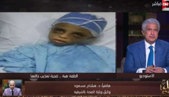 "صحة الشرقية" عن ضحية الاعتداء من خالتها: حبوبة جدا ومتستحقش التعذيب