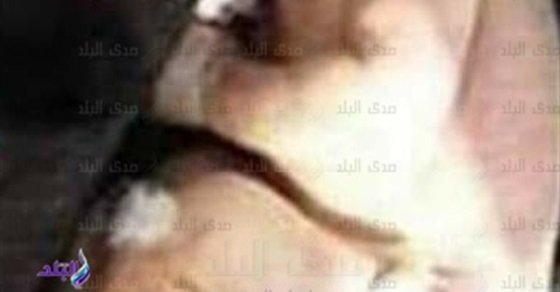 عثر عليها الأطفال أثناء لهوهم.. انتشال طفلة رضيعة من كوم قمامة برشيد