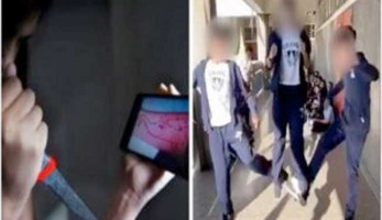 تهدد بشلل رباعي والوفاة.. "كسارة الجمجمة" تحد خطير ينتشر في المدارس