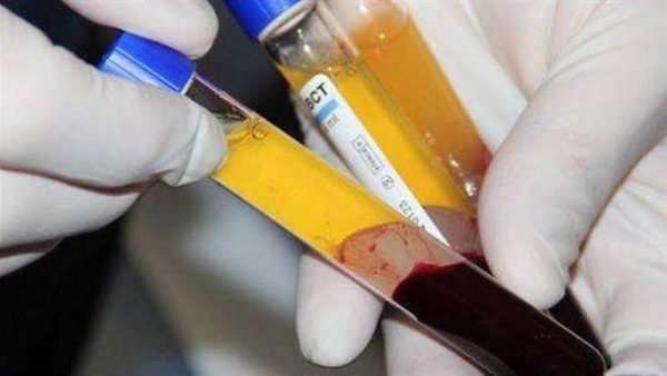 صدمة لبعض مصابي كورونا بشأن بلازما المتعافين
