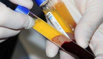 صدمة لبعض مصابي كورونا بشأن بلازما المتعافين