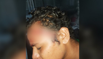 بالصور.. بلطجي يشوه وجه شاب في الغردقة