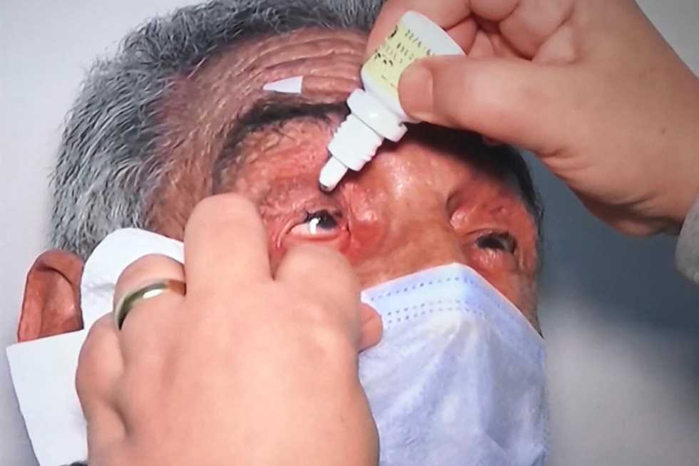 عمرو الليثي: والد بوسي أجرى عملية جراحية في عينه اليمنى