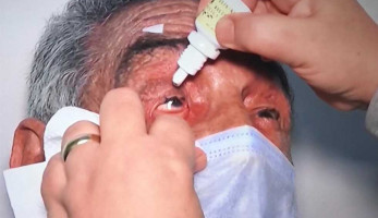 عمرو الليثي: والد بوسي أجرى عملية جراحية في عينه اليمنى