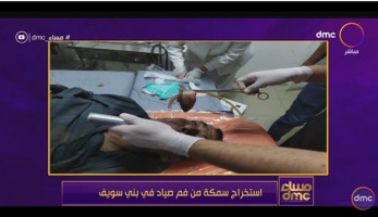 شاهد.. تفاصيل استخراج سمكة حية من فم صياد في بني سويف