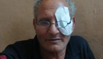 أول صور للمتضررين من فشل عمليات المياه البيضاء داخل مركز خاص بطنطا