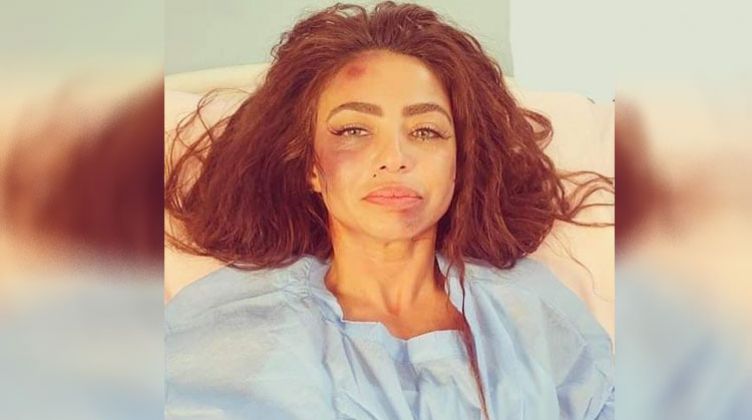 صور| دوللي شاهين تتعرض للضرب من مجهولين