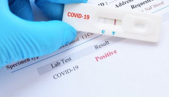 مقترح برلماني باعتماد بيع الكاشف السريع rapid test بالصيدليات للكشف كورونا