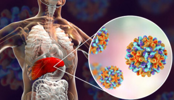 هل هناك علاقة بين فيروس الكبد الجديد و«كورونا»؟.. مصدر بالصحة يكشف تفاصيل مهمة