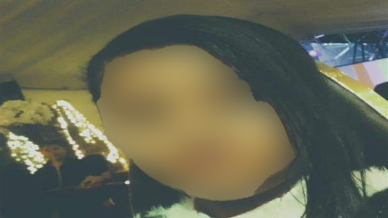 بالصور- إصابة طفلة بطلقات خرطوش في "زفة فرح" ببورسعيد