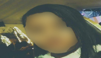 بالصور- إصابة طفلة بطلقات خرطوش في "زفة فرح" ببورسعيد