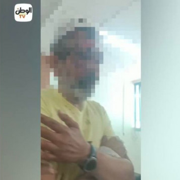 انفراد صحيفة الوطن.. نشر بدون استئذان