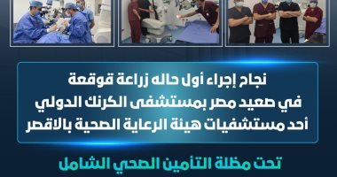 نجاح أول زراعة قوقعة فى صعيد مصر بمستشفى الكرنك الدولى بالأقصر