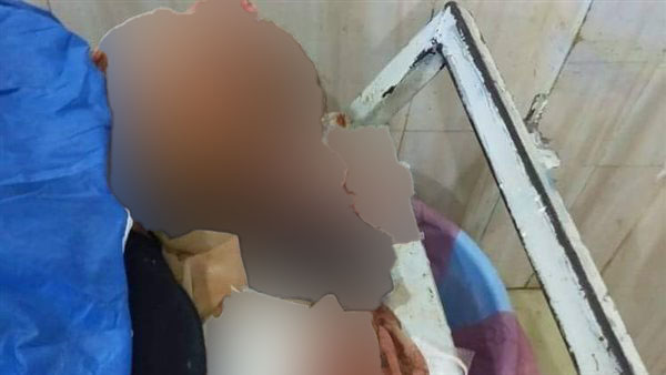«عمليات المعلمين»: أسرة تعتدى على معلمة وإصابتها بجروح خطيرة فى البحيرة