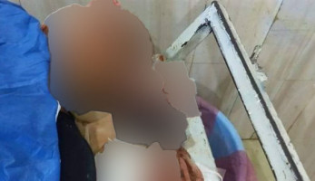 «عمليات المعلمين»: أسرة تعتدى على معلمة وإصابتها بجروح خطيرة فى البحيرة