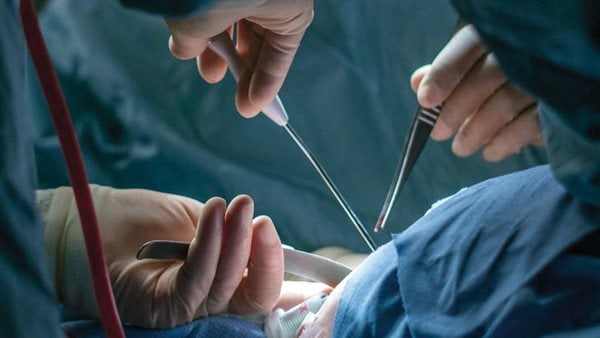 الصحة تصدر نموذجا لتوثيق التبرع بالأعضاء بعد الوفاة.. وكارنيه للمتقدم قريبًا | خاص